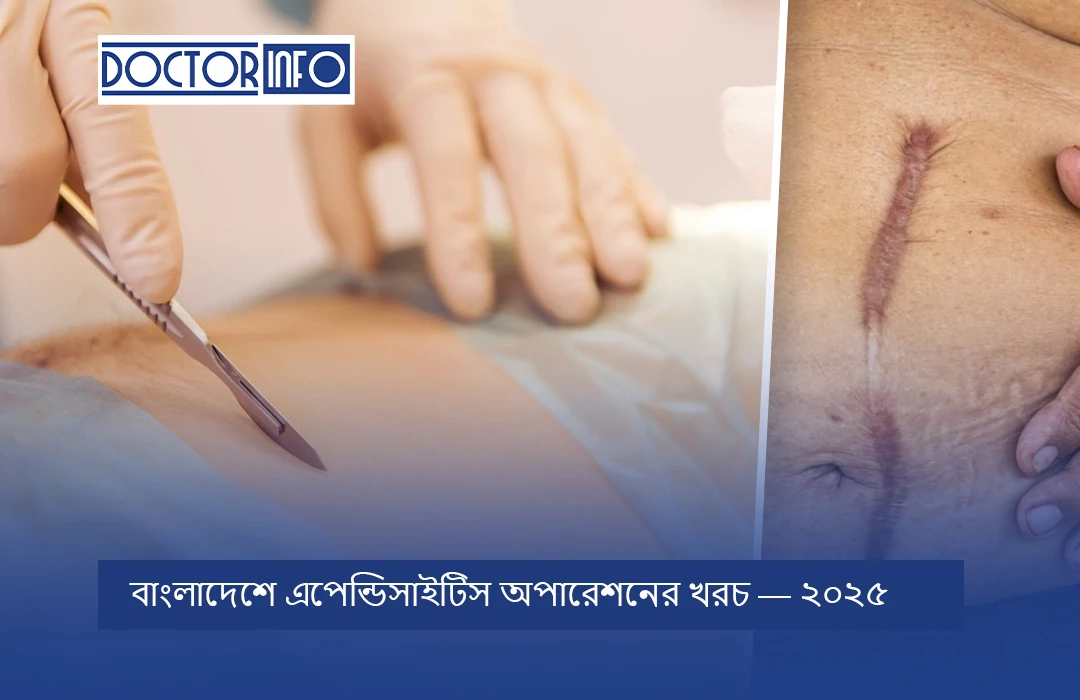 বাংলাদেশে এপেন্ডিসাইটিস অপারেশনের খরচ — ২০২৬