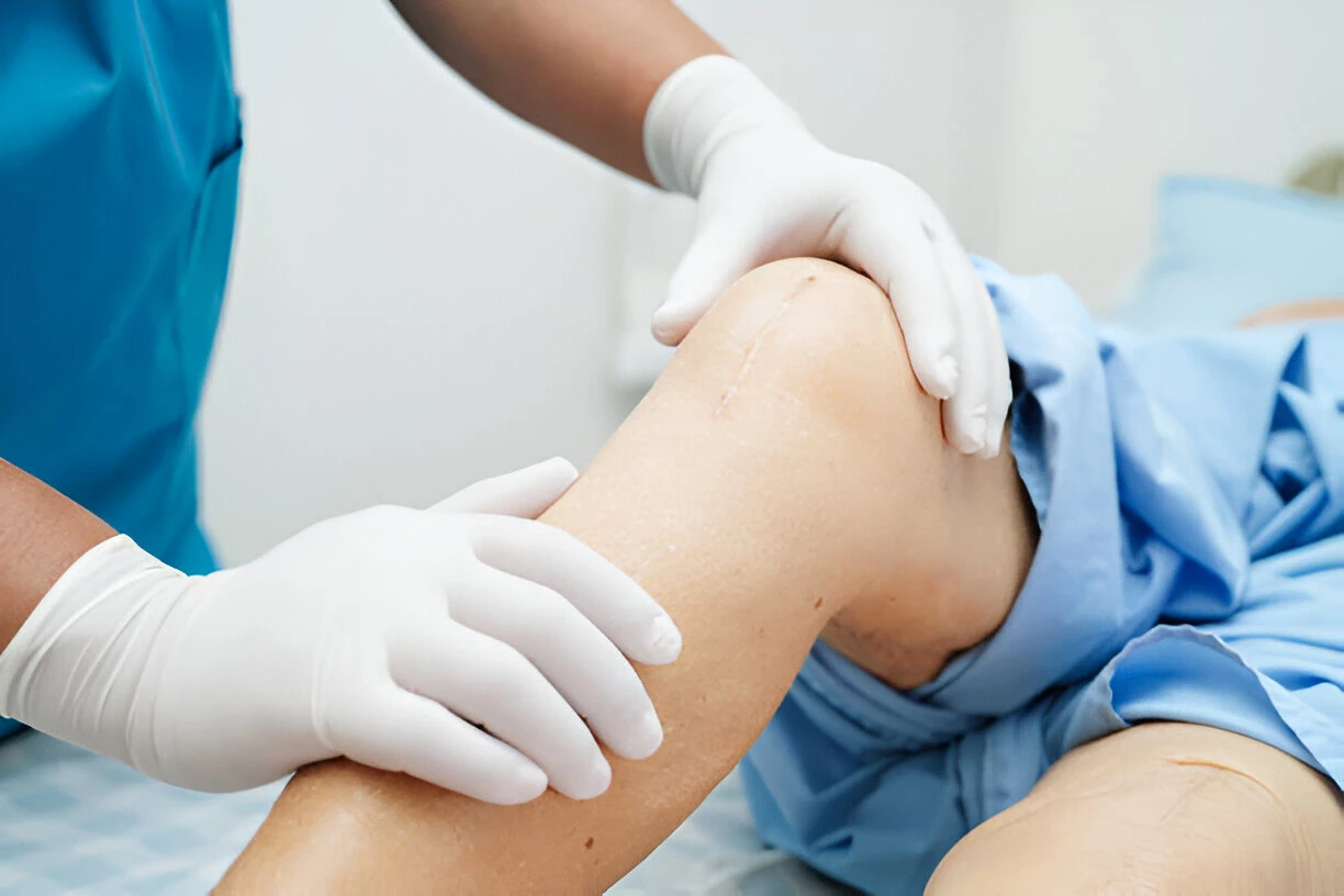 Top Knee Surgery Doctors in Dhaka: The Right Solution for Your Knee Problem